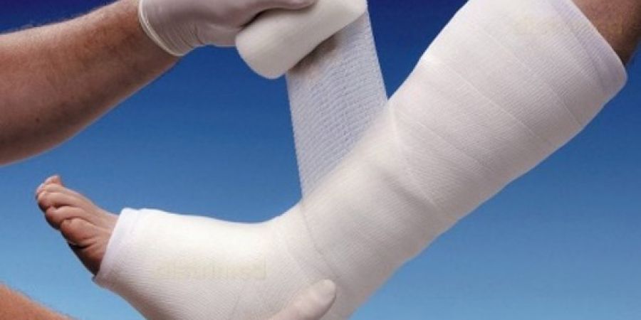 Consigli: rinforzare o chiudere il gesso con Scotch Cast