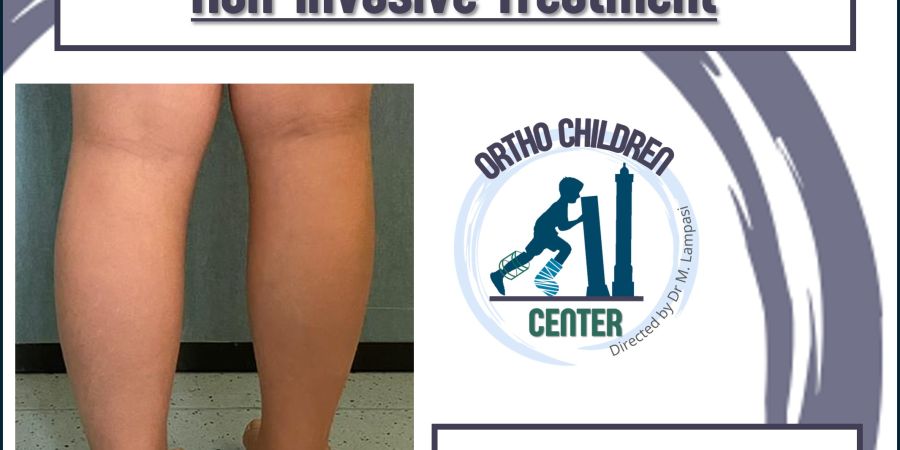 New sheet: treatment of Leg Length Discrepancy in children (Hemi-epiphysiodesis or guided growth)