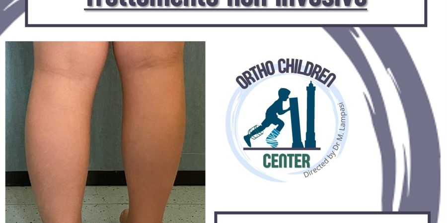 Nuova scheda: trattamento della differenza di lunghezza degli arti inferiori (epifisiodesi simmetrica)