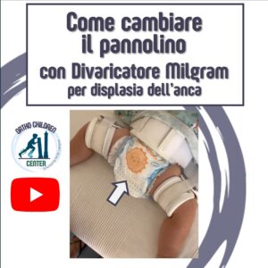 Nuovo tutorial: Come cambiare il pannolino con tutore Milgram per displasia dell’anca