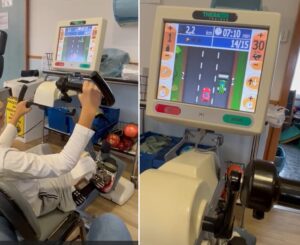 Primo fissatore esterno in Italia tipo Drive Rail con Hinge sul ginocchio