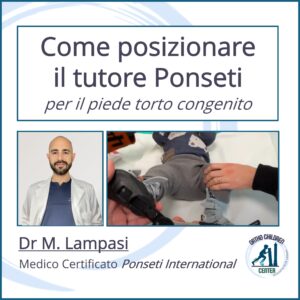 Nuovo tutorial: come posizionare il tutore Ponseti per il piede torto congenito (dr Lampasi, medico Certificato Ponseti International)