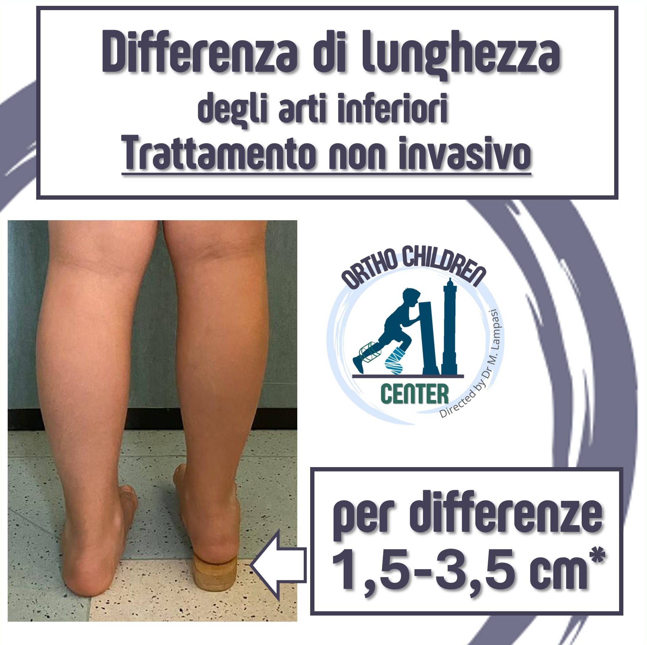 Nuova scheda: trattamento della differenza di lunghezza degli arti inferiori (epifisiodesi simmetrica)