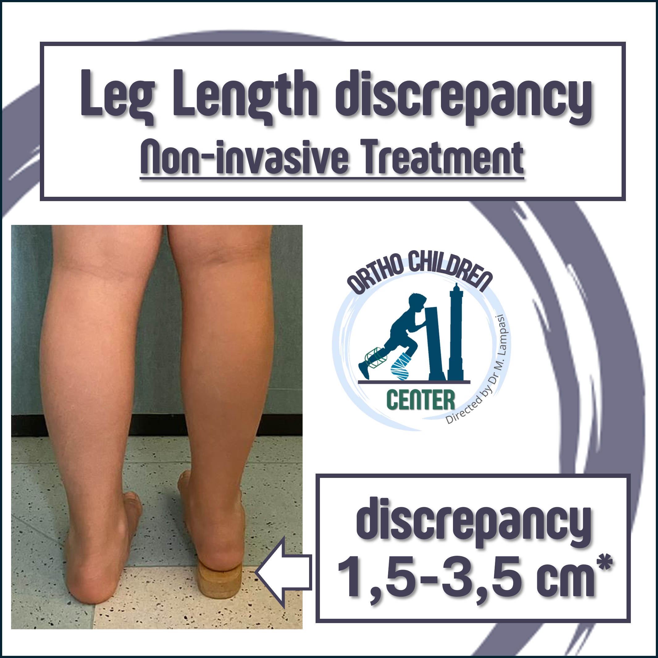 New sheet: treatment of Leg Length Discrepancy in children (Hemi-epiphysiodesis or guided growth)