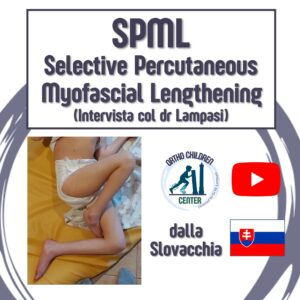 SPML (Selective Percutaneous Myofascial Lengthening): indicazioni, benefici, rischi. Intervista col dr Lampasi