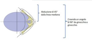 Abduzione =divaricazione delle anche