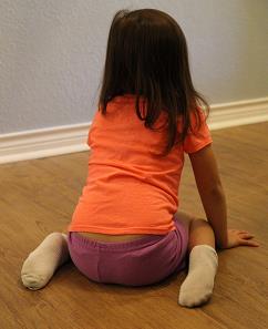 Seduta a “W” (Tratto da Reruchaet al. Lower Extremity Abnormalities in Children. Am Fam Physician. 2017)
