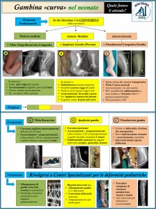 Curvatura congenita della gamba: come distinguere? schema ideato dal dr Lampasi