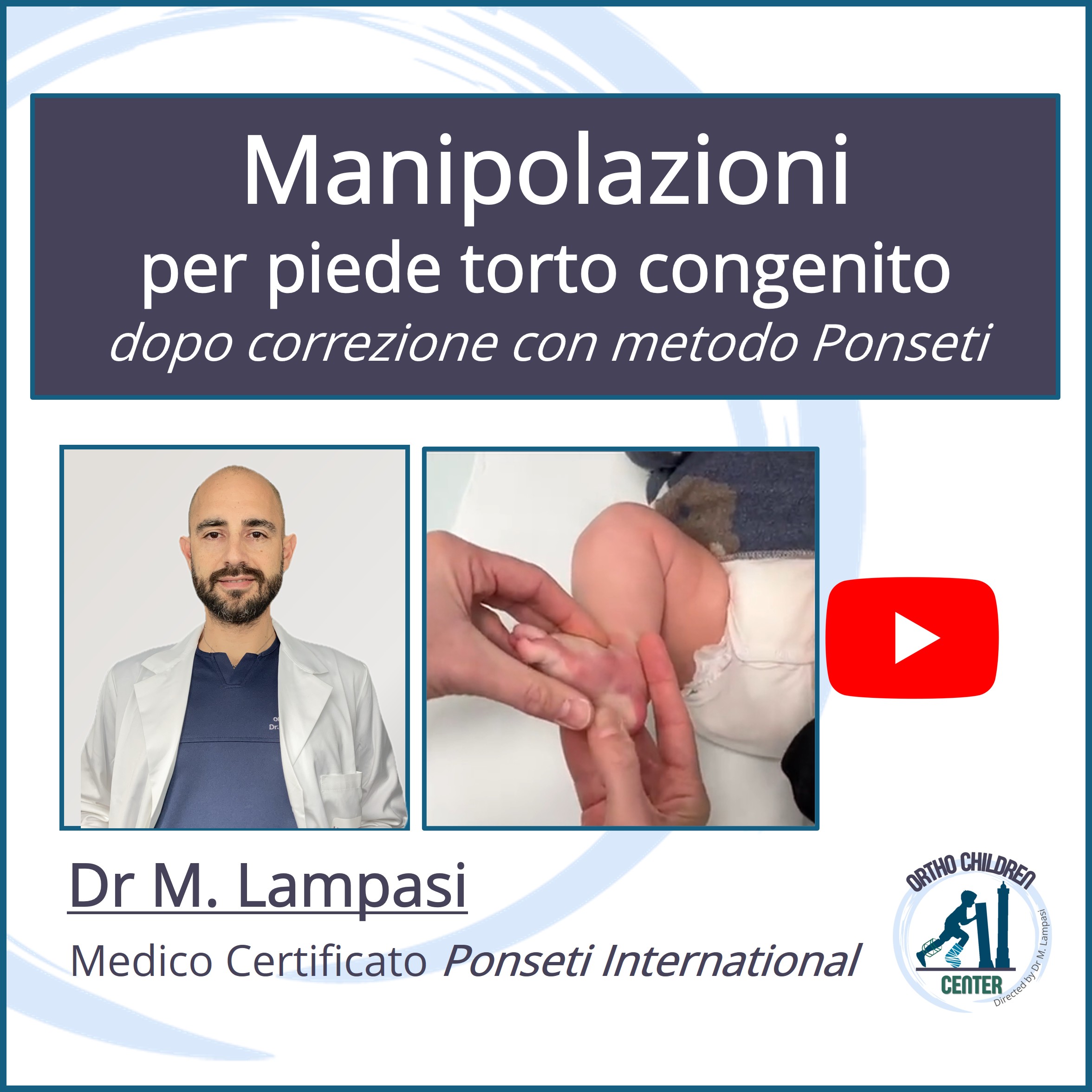 Nuovo tutorial: Manipolazioni per Piede torto congenito dopo correzione con metodo Ponseti (dr M.Lampasi, medico certificato)