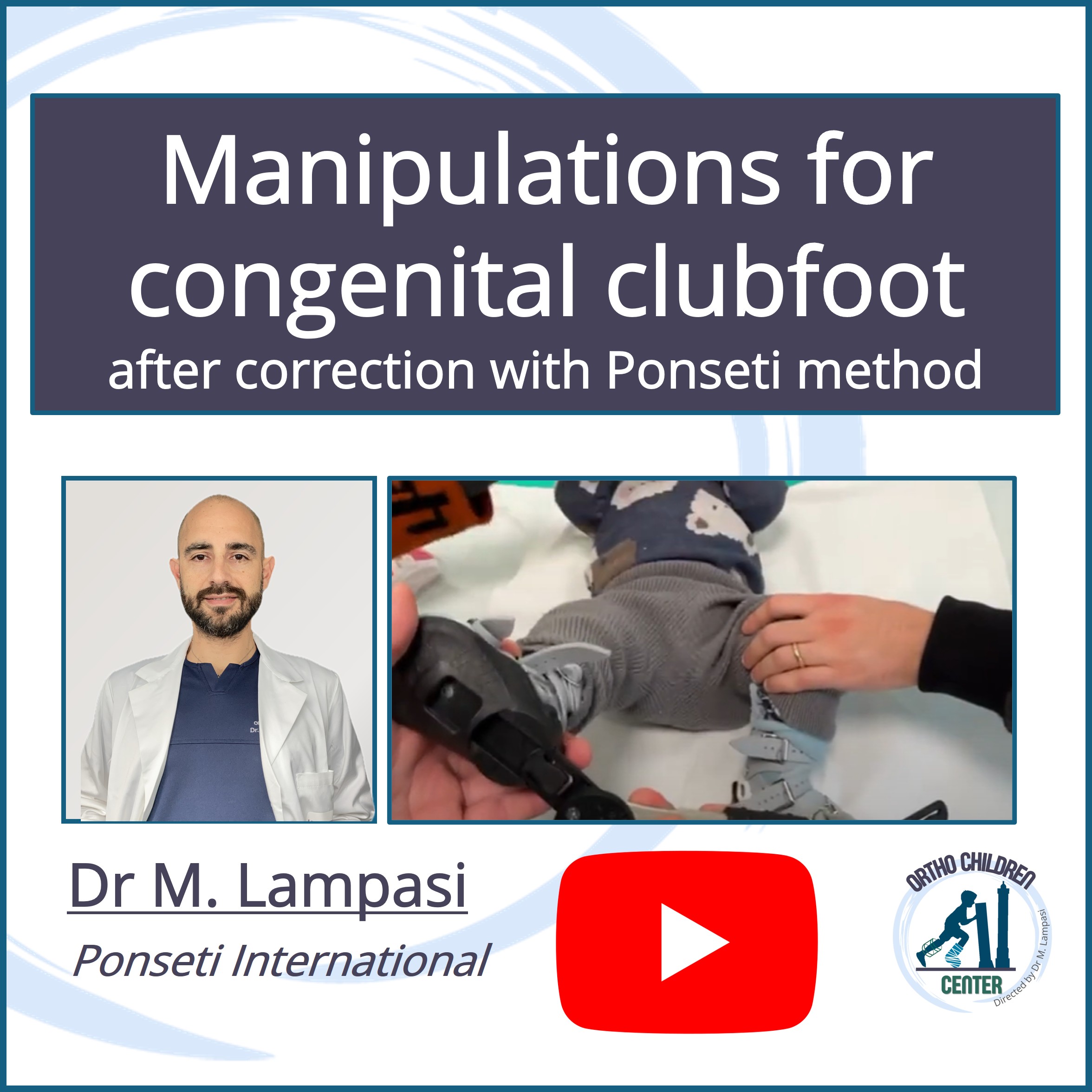 New tutorial: Manipulations for clubfoot after correction with the Ponseti method (Dr. M. Lampasi)