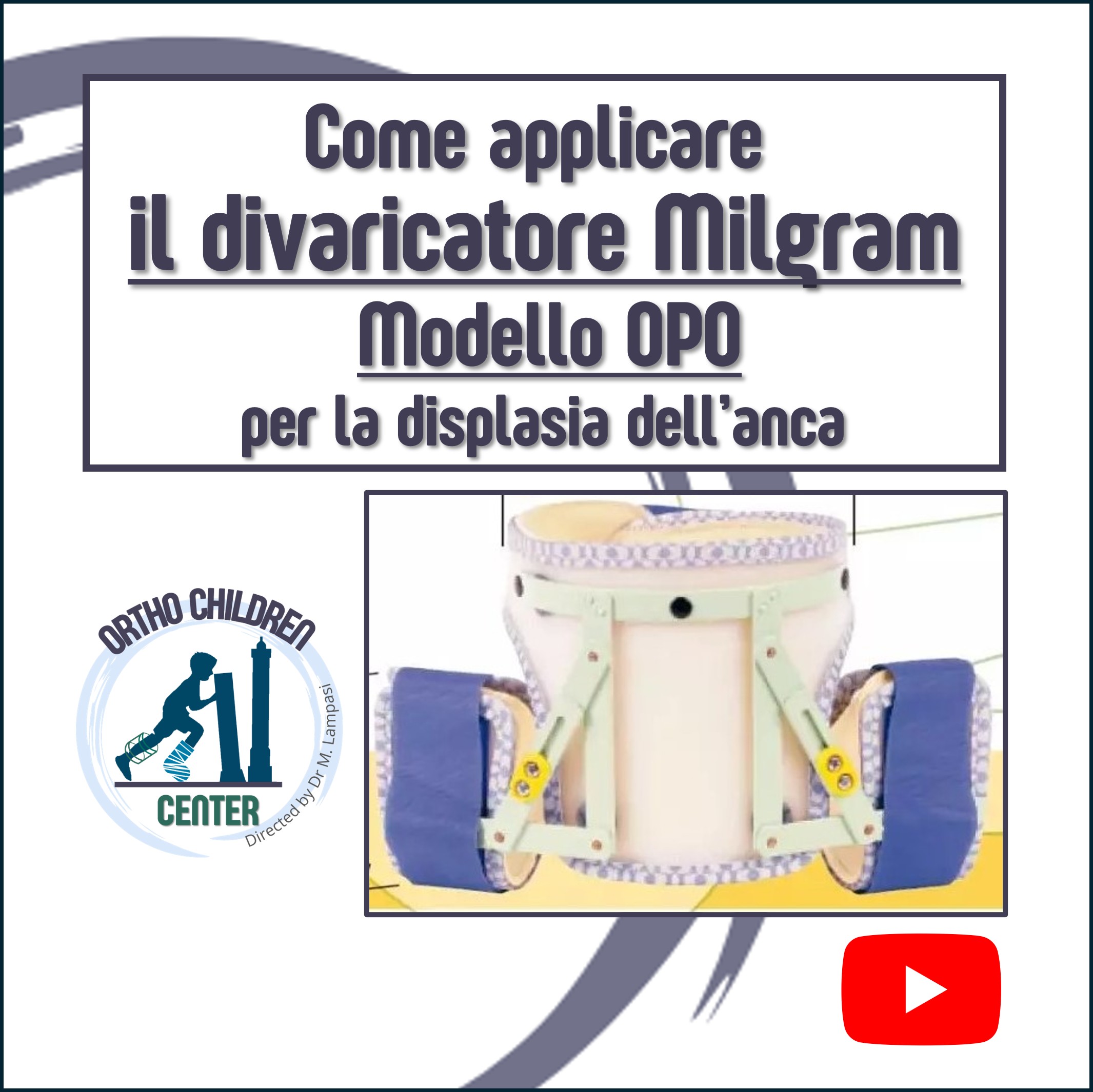 Come applicare il divaricatore Milgram OPO per la displasia dell’anca