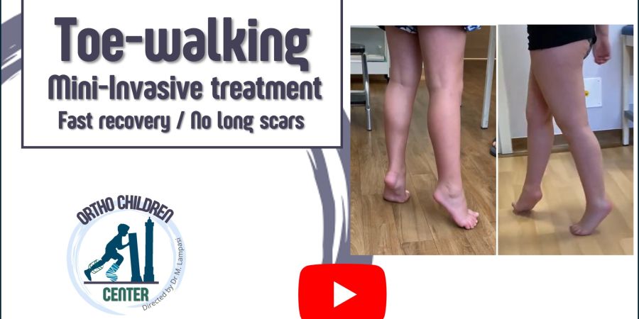 New video: “Toe walking in children: mininvasive operation, fast recovery, no long scars”