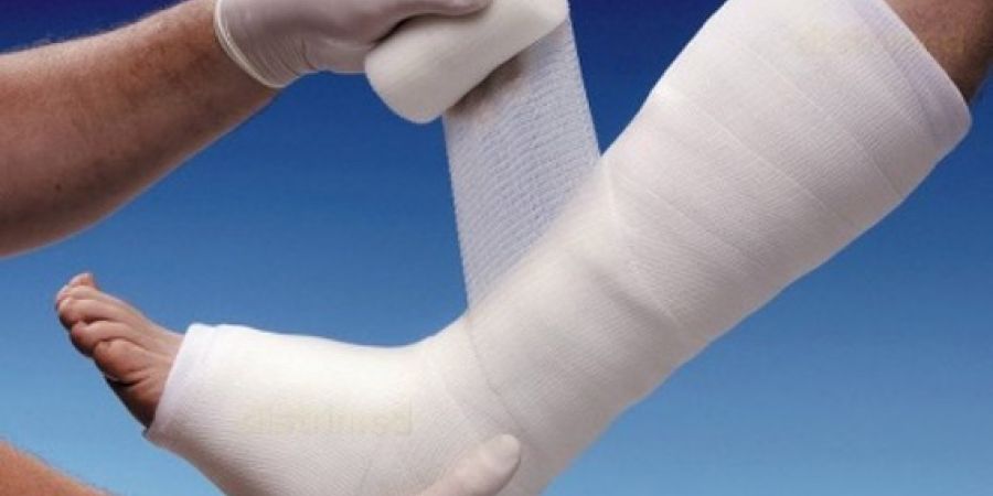 Consigli: rinforzare o chiudere il gesso con Scotch Cast