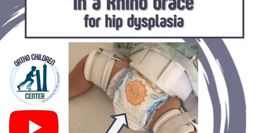 New tutorial: How to change a diaper in a Rhino brace for hip dysplasia