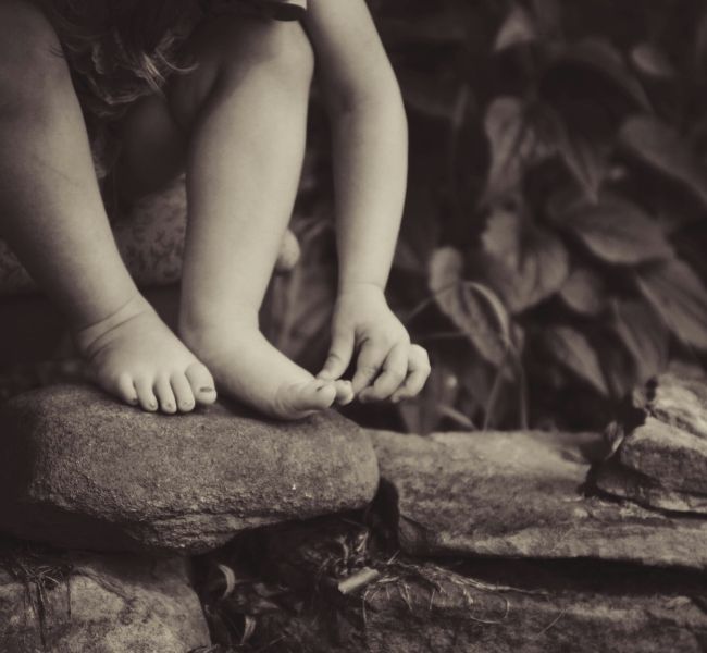 Piede torto congenito