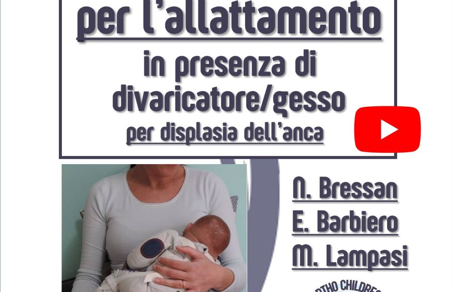 Nuovo tutorial: come allattare in presenza di un divaricatore o gesso per displasia congenita dell’anca