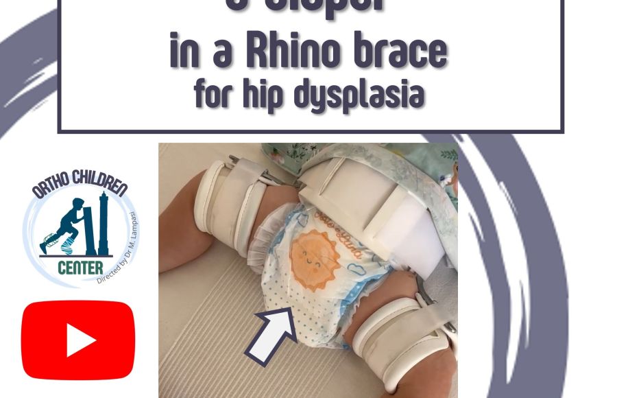New tutorial: How to change a diaper in a Rhino brace for hip dysplasia
